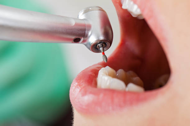Best Walk-In Emergency Dentist in Hartley, CA